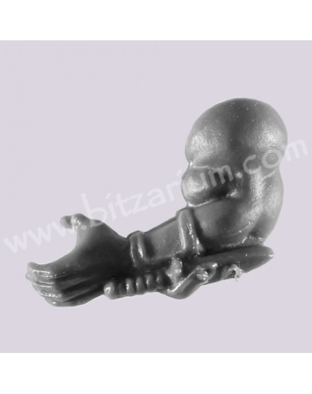 Left Arm 1
